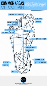 Common areas for foot pain